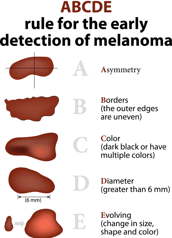 Skin Cancer Surgical Center