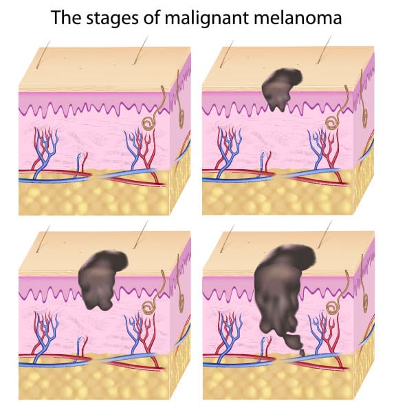 Skin Cancer Surgical Center