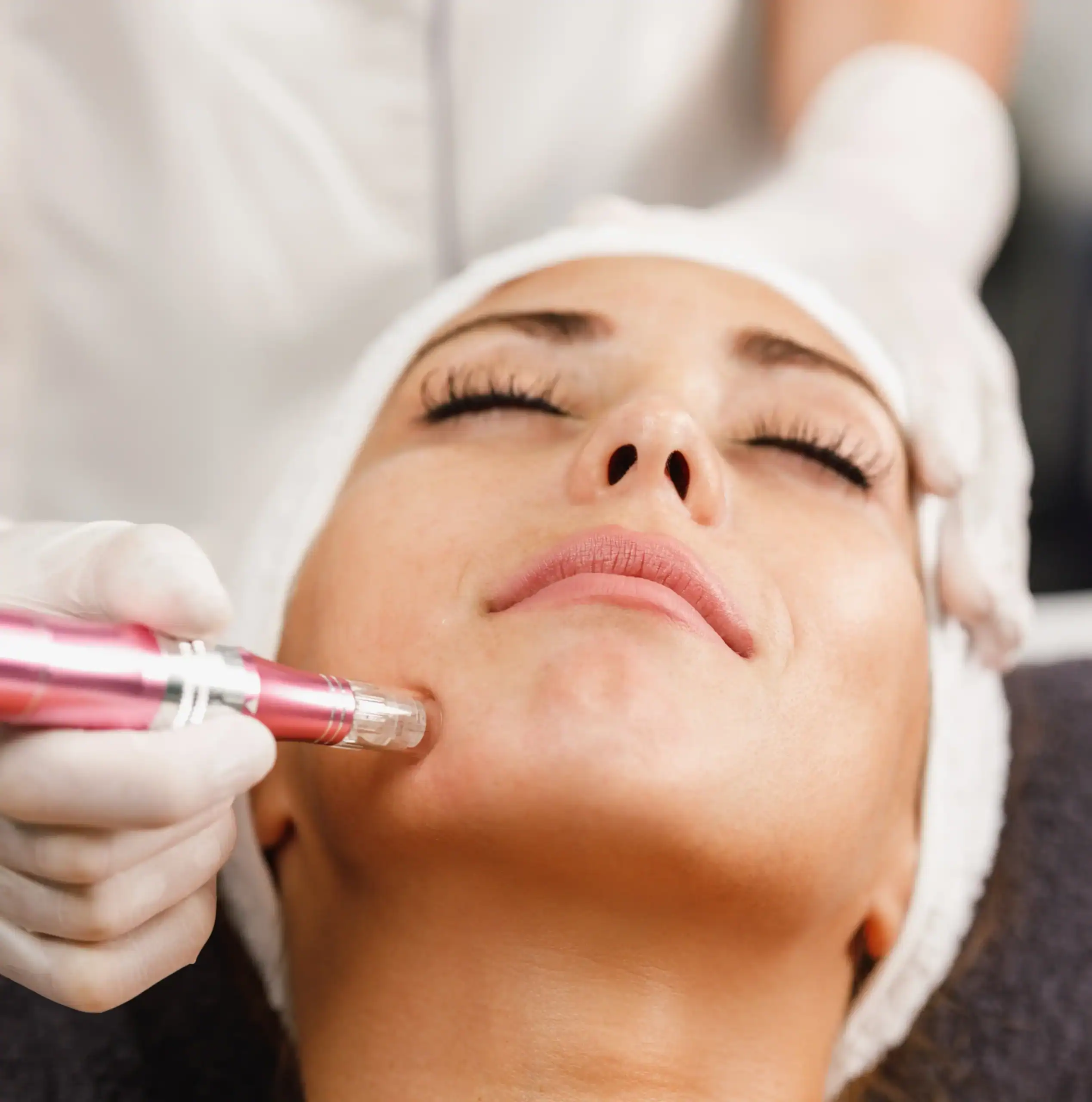 Woman gets dermapen micro-needling treatment