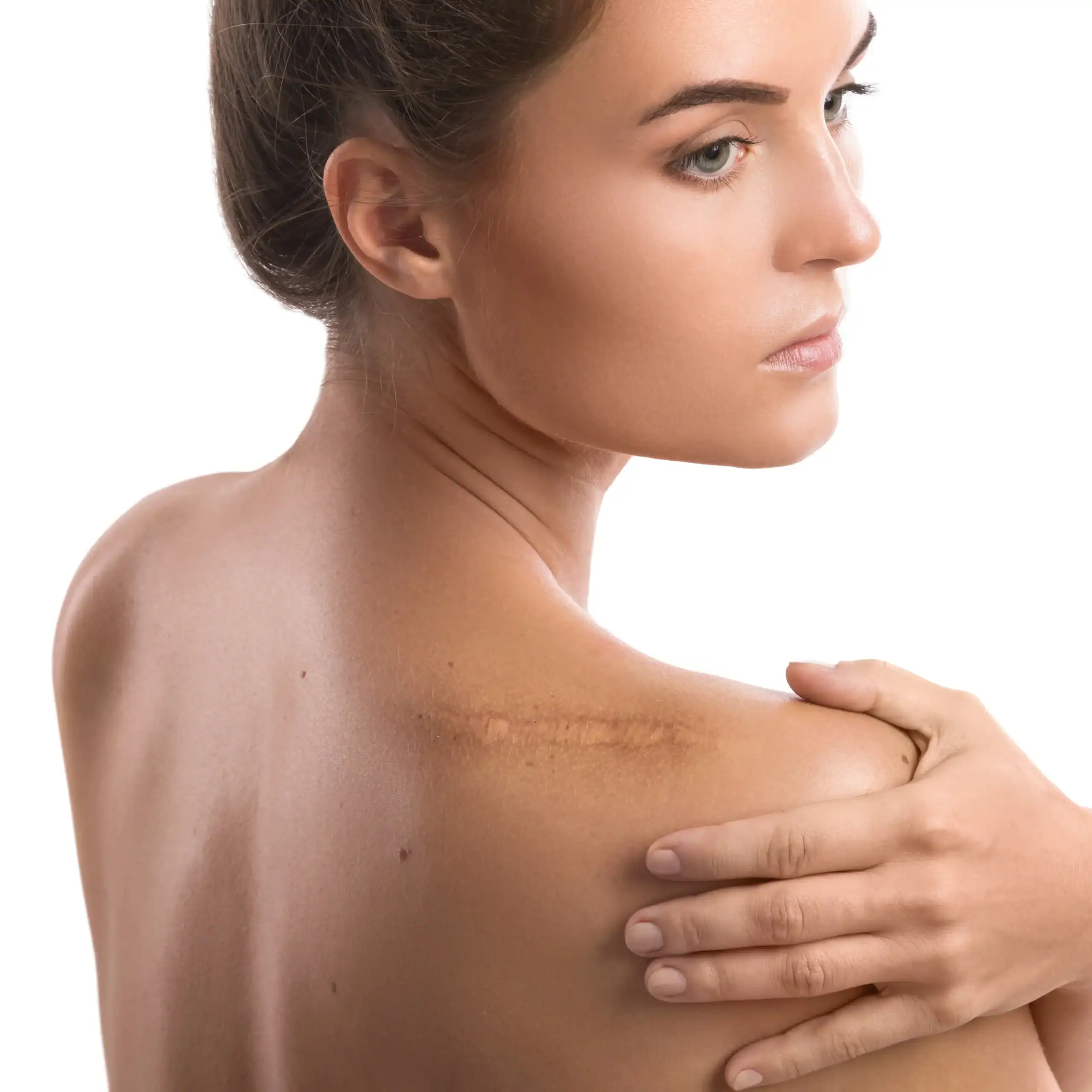 Woman touches scar on her shoulder