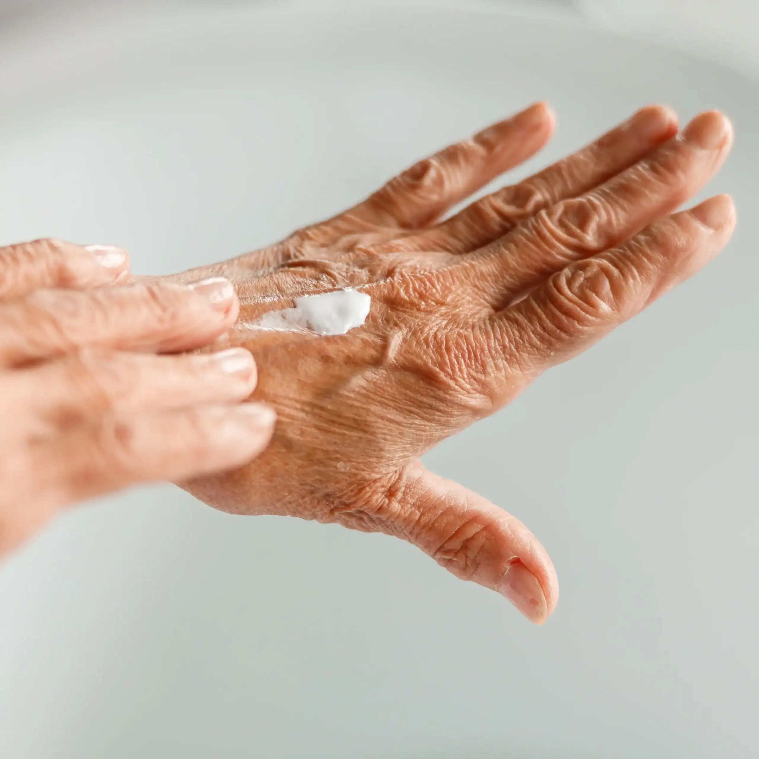 Woman puts a topical treatment on her hand