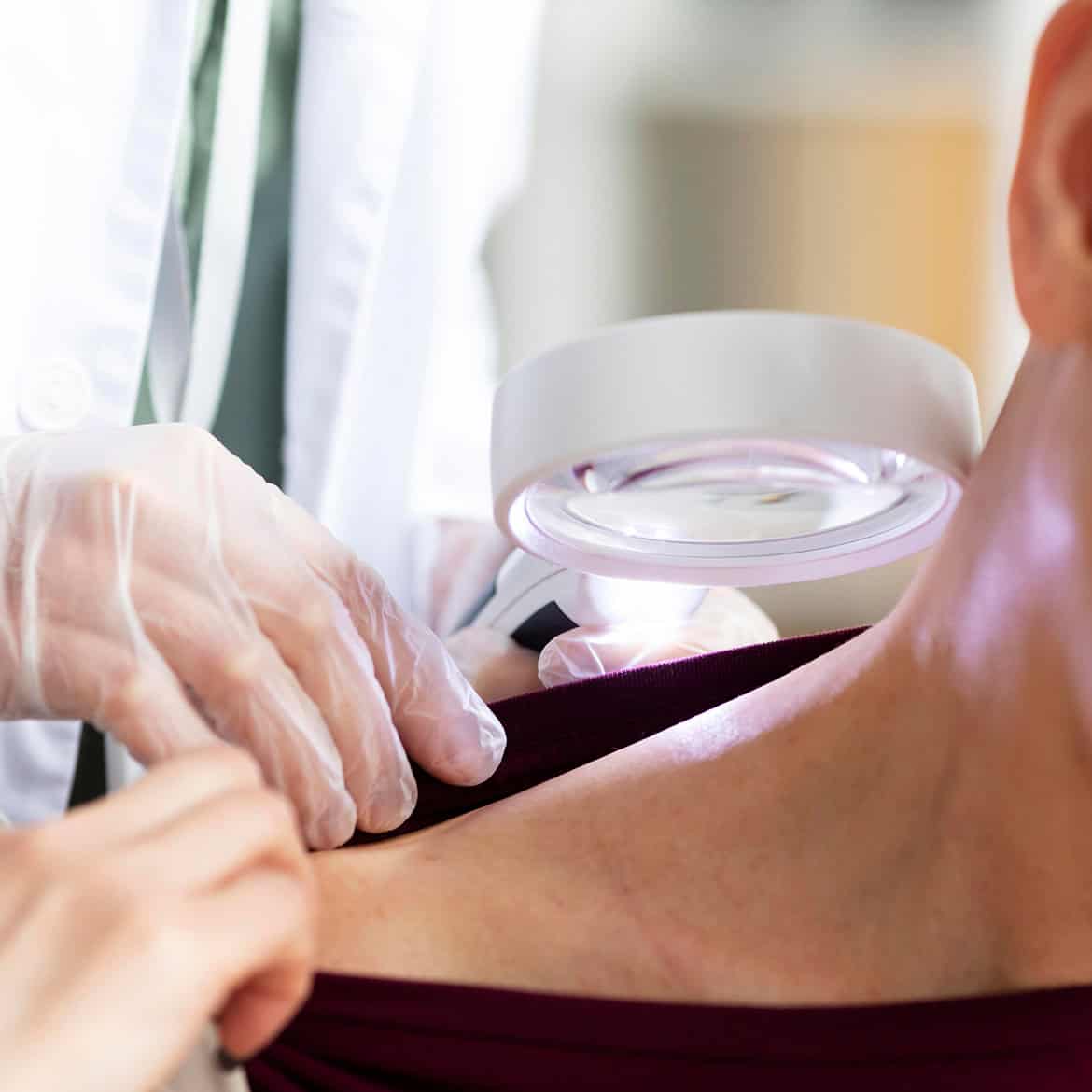 Un dermatólogo examina la piel de la espalda de una mujer