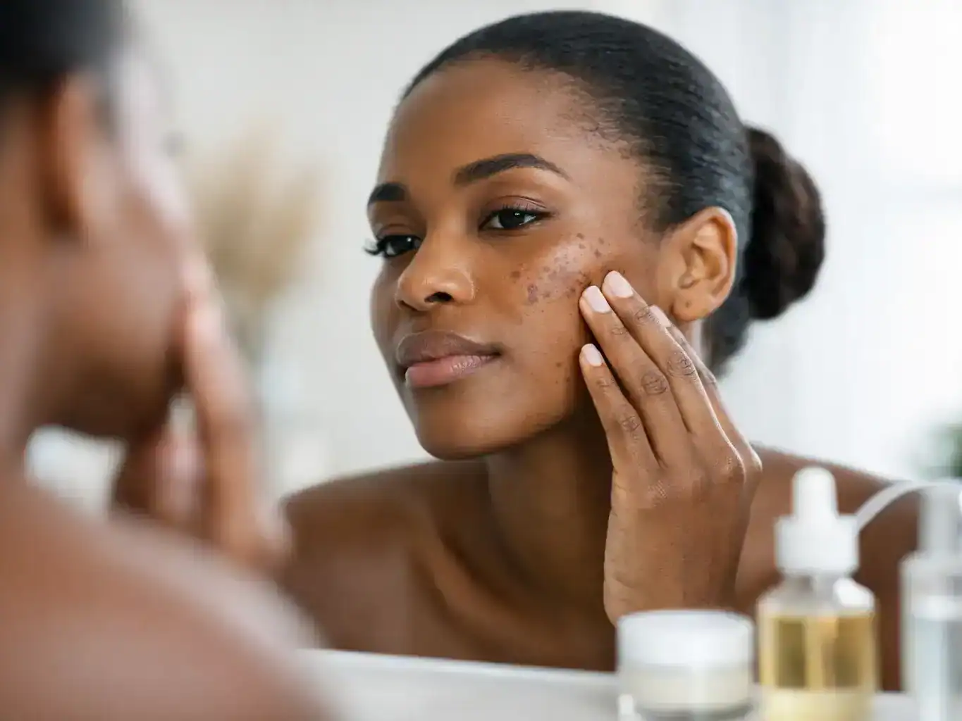 Hyperpigmentation Care for Dark Skin
