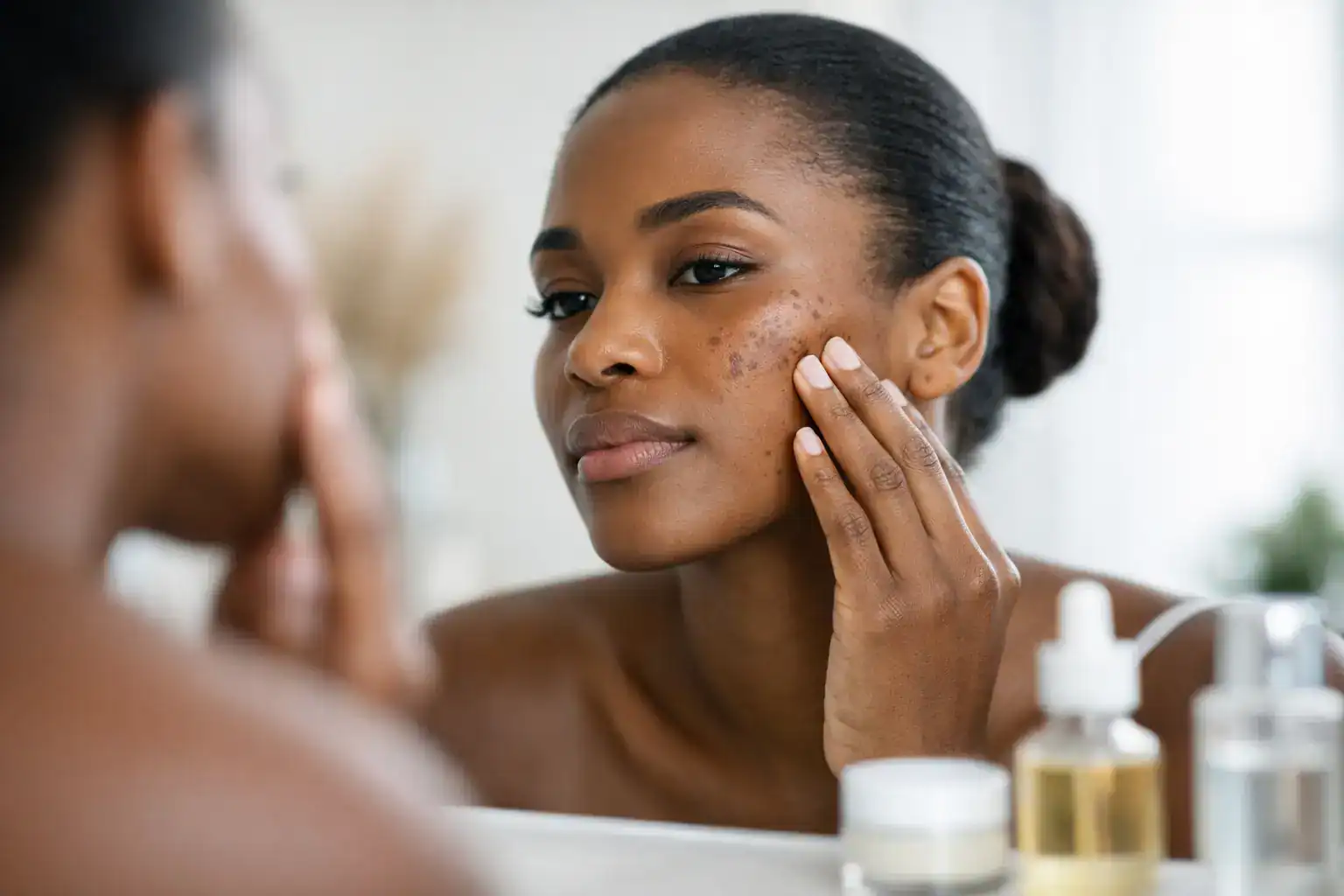 Hyperpigmentation Care for Dark Skin