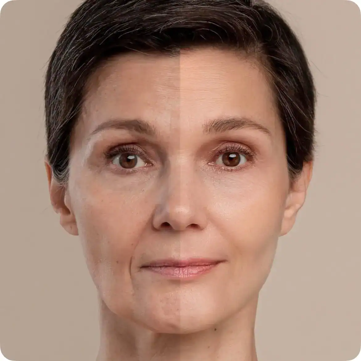 El rostro de una mujer antes y después de un tratamiento