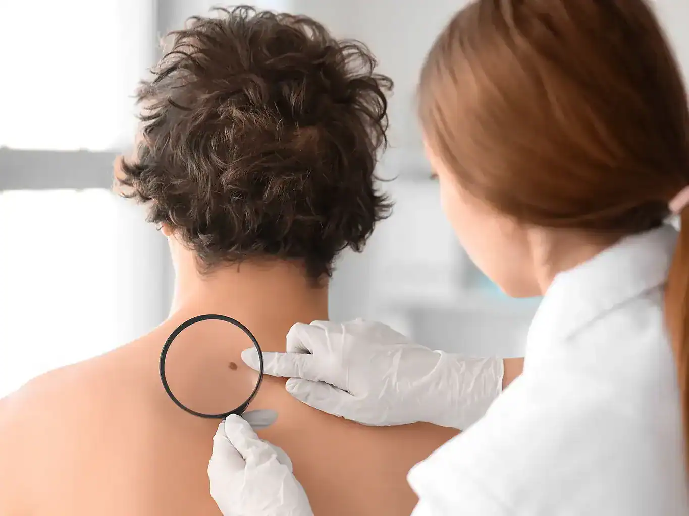 A dermatologist in a white coat looks at a mole on a male patient's back to see if it is melanoma.