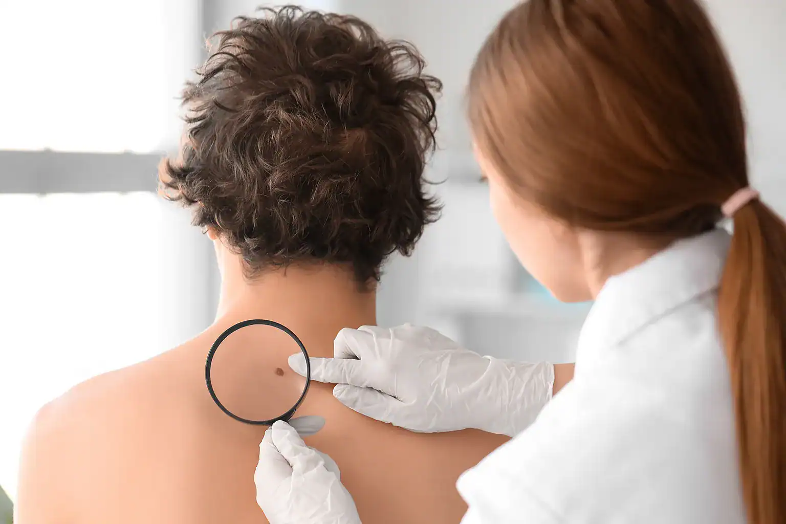 A dermatologist in a white coat looks at a mole on a male patient's back to see if it is melanoma.