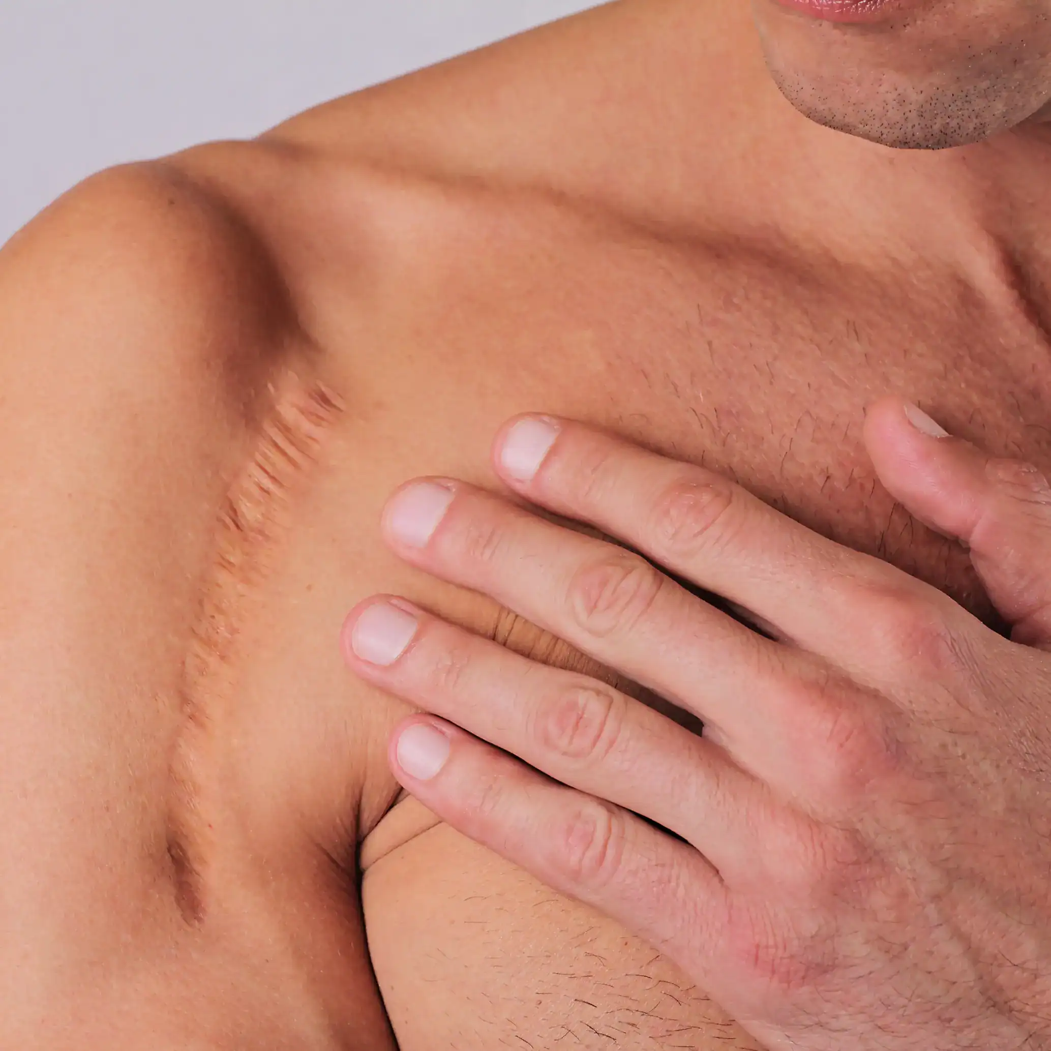Man with major scar on his shoulder