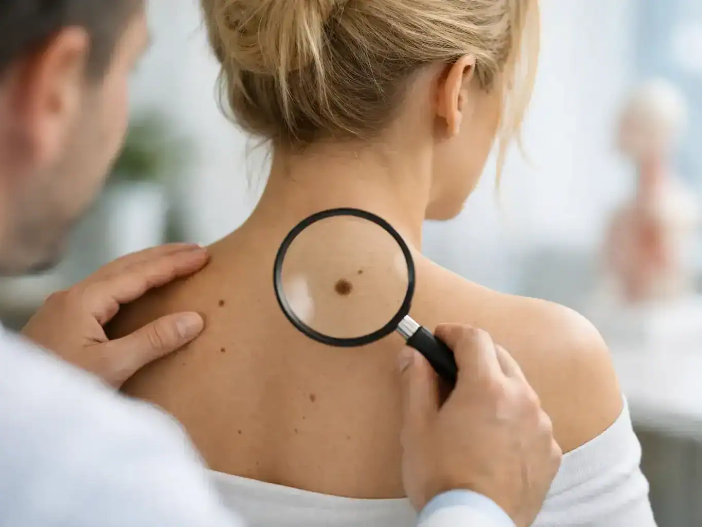 When Should Moles Be Checked?